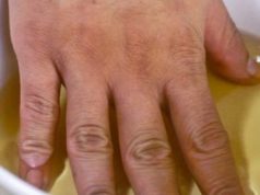 ISPROBAJTE I UVJERITE SE: Jabukovo sirće – provjereno oružje u borbi protiv artritisa i bolova u zglobovima.